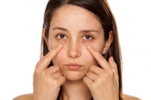 Làm cách nào để giảm thiểu bọng mắt và quầng thâm?
